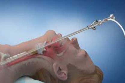 Flexible and Rigid Bronchoscopy