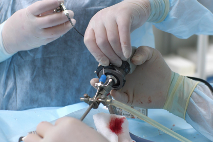 General Laparoscopic and Bariatric Surgery