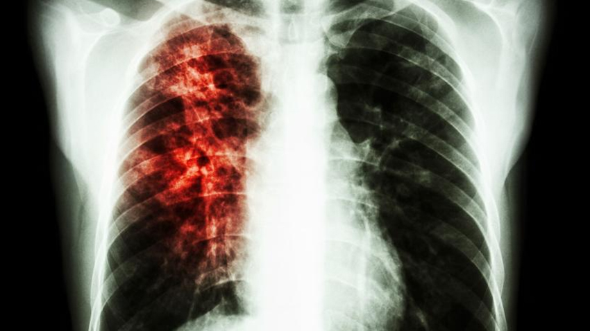Pulmonary and critical care Medicine